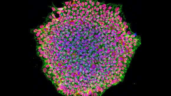 Jepang Setujui Obat Stem Cell untuk Parkinson dan Gagal Jantung Meski Data Masih Terbatas