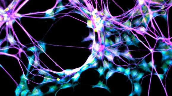 Penemuan Neurogenesis Membantu Memahami Cara Otak Menjaga Memori di Usia Tua