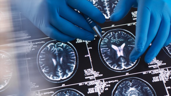 BioRxiv Jadi Pilihan Utama Ilmuwan Neurosains untuk Sebarkan Riset Cepat