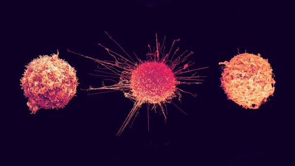 Improving cancer survival rates will require hard policy choices