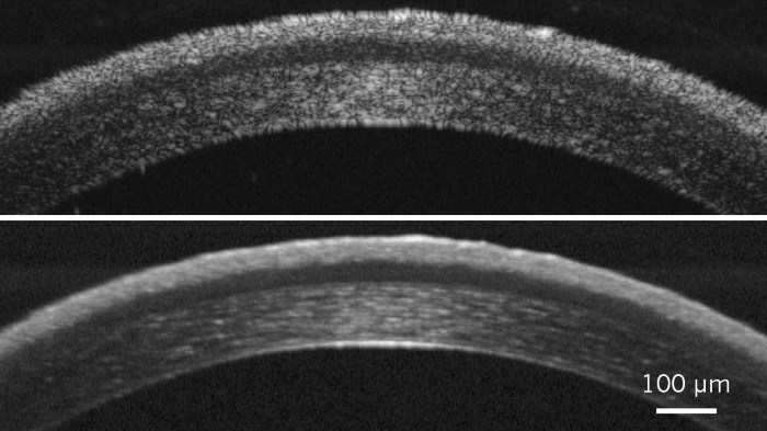 Scans of a mouse cornea get sharper by using improved optical coherence tomography