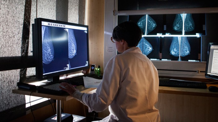 A breast tumour spotted on a mammogram marks the start of years of vigilance.