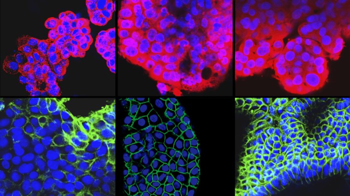 Protein tags reveal that miniature liver tumours assembled in the lab have much in common with their parent tumours.