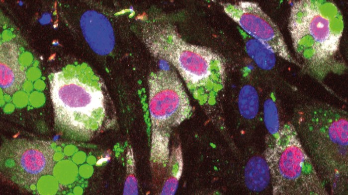 Single-cell immunofluorescence assay showing precursor cells maturing into adipose cells full of fat