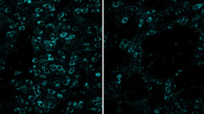 mGluR5 gene editing