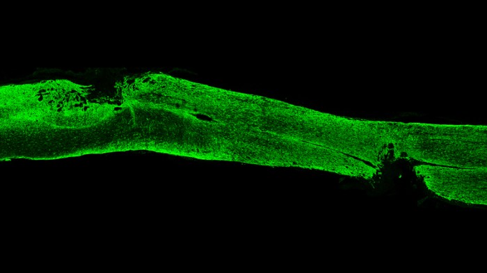Mouse spinal cord with lesion