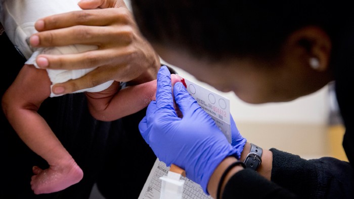 Infant being tested for phenylketonuria