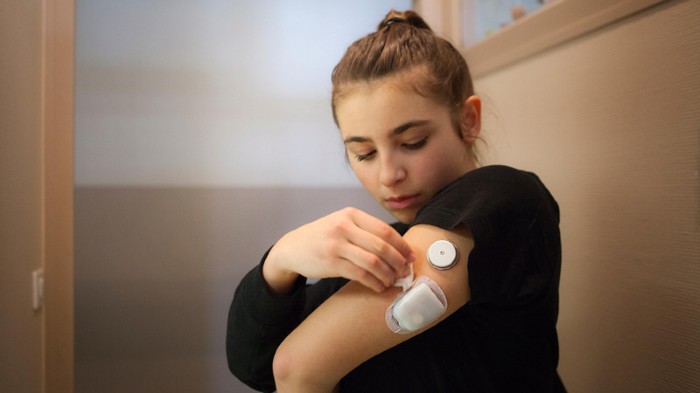 Teenager with a glucose sensor and insulin pump.