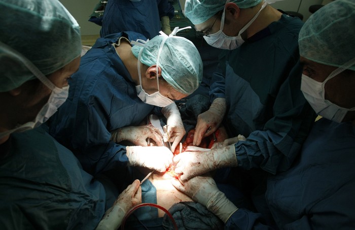 Surgeons extract the liver and kidneys of a brain-dead woman.