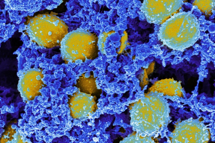 Coloured scanning electron micrograph of methicillin-resistant Staphylococcus aureus bacteria
