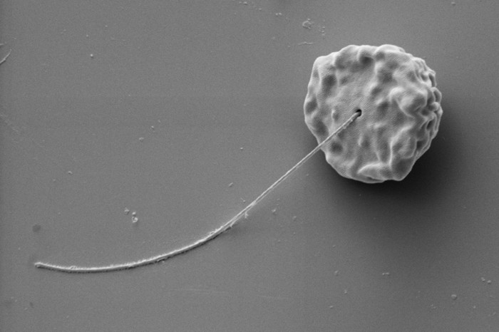 Scanning electron micrograph of Idionectes vortex with flagellum
