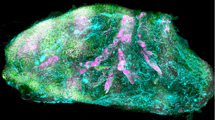 3D reconstruction of whole adult human kidney imaged by the prototype light-sheet microscope.