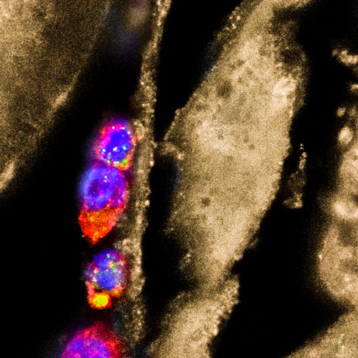 Macrophages adhering to the surface of larvae of the nematode parasite Heligmosomoides polygyrus bakeri.