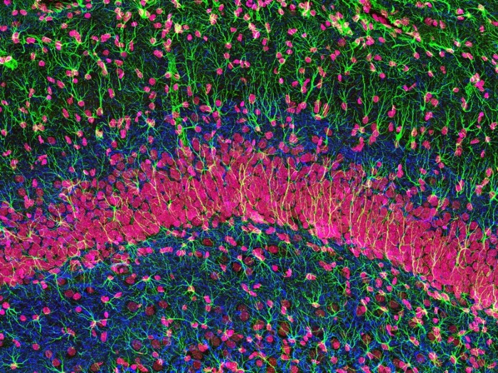 Coloured micrograph of cells with a band of red across the middle, green dotted with red above and blue dotted with red below.