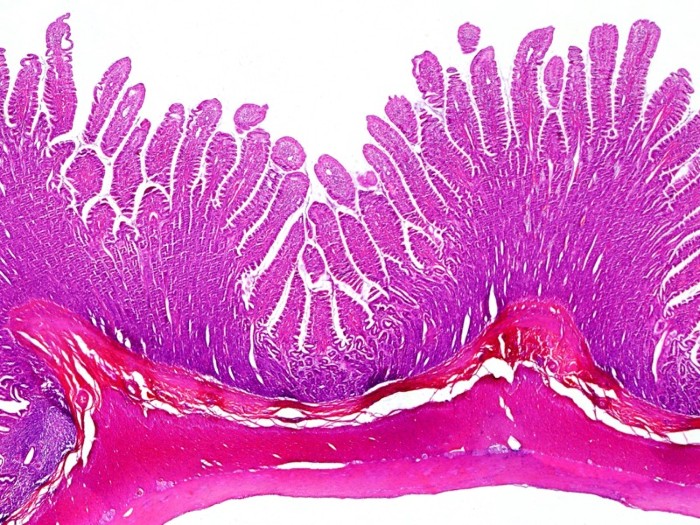 Light micrograph of a normal human colon in the large intestine.