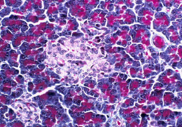 Light micrograph of a section through an islet of Langerhans in pancreas tissue.