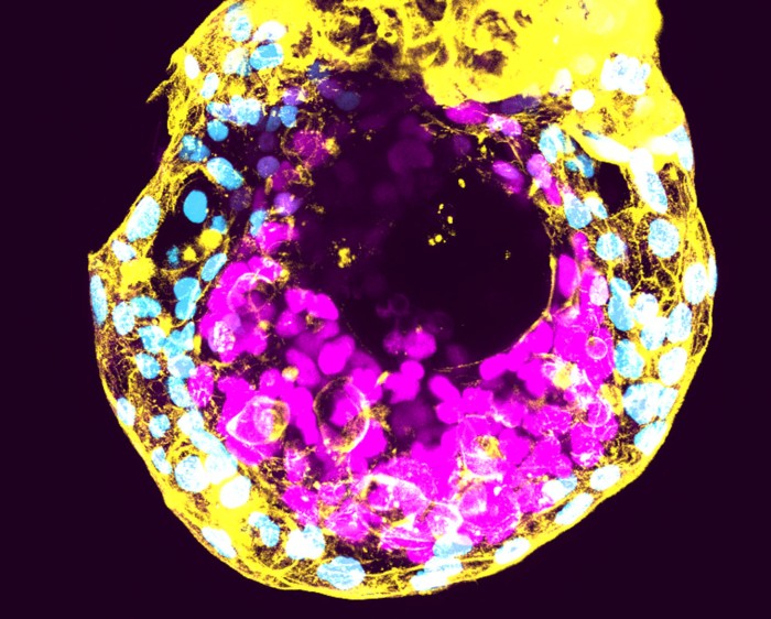 Day 12 human embryo cultured and stained to reveal the Epiblast OCT4 (magenta), the Hypoblast GATA6 (Cyan) and F-Actin (yellow).