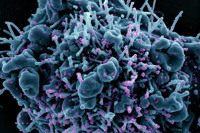 Colorized scanning electron micrograph of a cell infected with SARS-CoV-2 virus particles