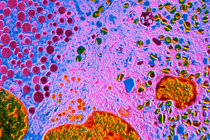 A coloured electron transmission showing insulin-secreting beta cells in the human pancreas