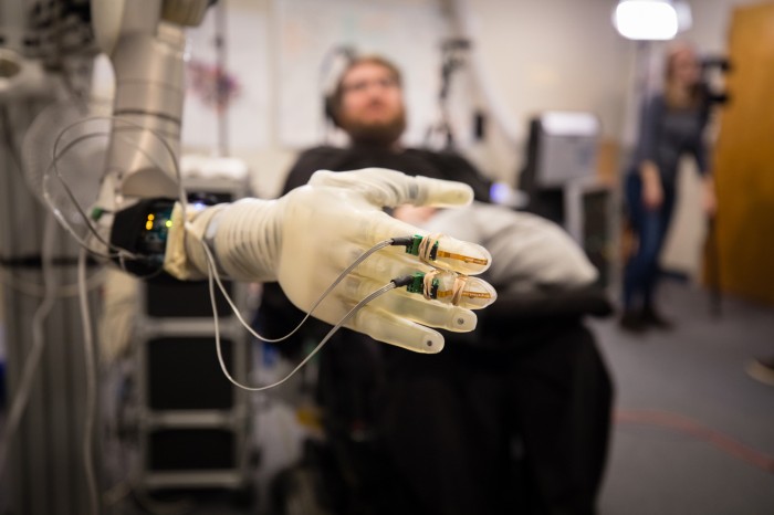 A paralysed man uses a brain-computer interface connected to his brain through his head controls a prosthetic arm and hand