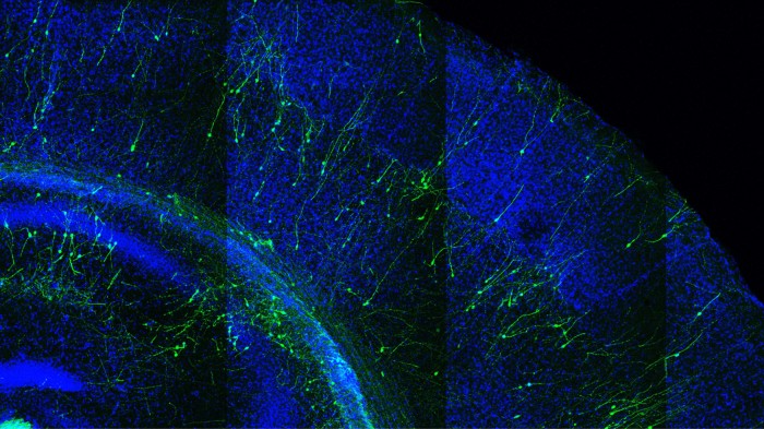 Human stem-cell derived neurons transplanted into a mouse brain