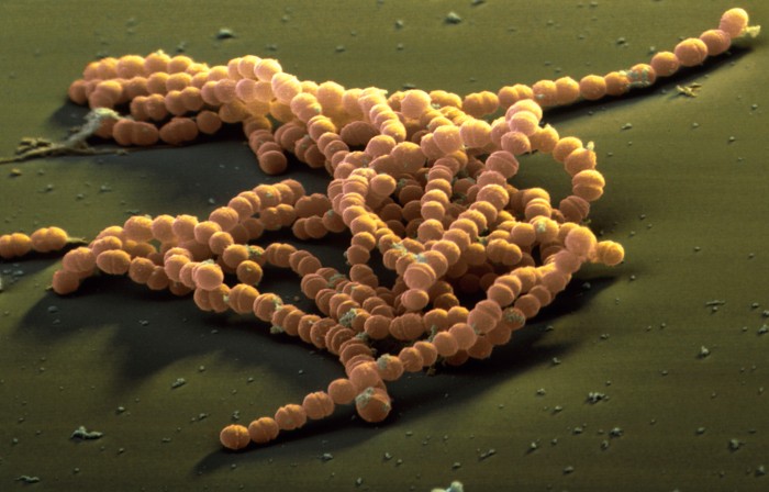 Streptococcus agalactiae bacteria, coloured SEM.