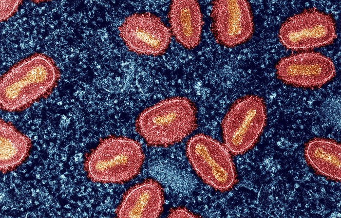 Coloured transmission electron micrograph showing red cells on a grainy blue background.