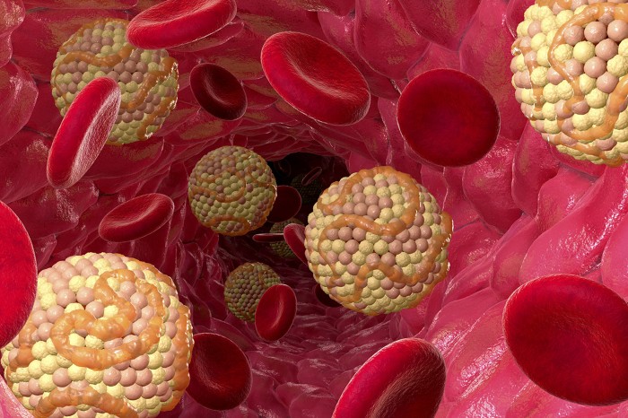 3D artwork of cholesterol moving through blood vessels with red blood cells