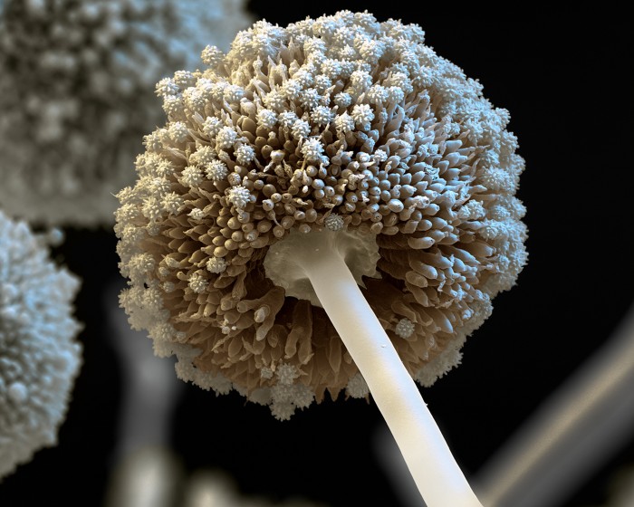 Aspergillus niger, SEM. Coloured scanning electron micrograph (SEM) of a fruiting body of the fungus A. niger, on the tip of a conidiophore.