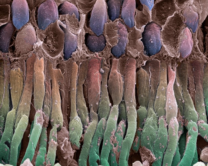 Coloured scanning electron micrograph of a section through a retina.
