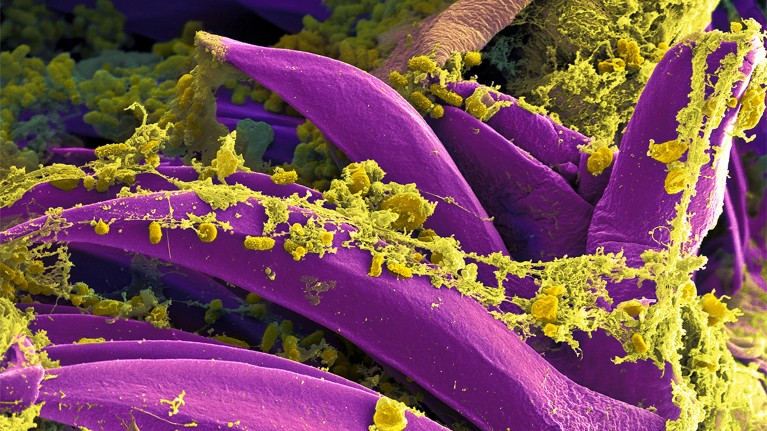 Modern plague bacteria on the spines of an Oriental rat flea.