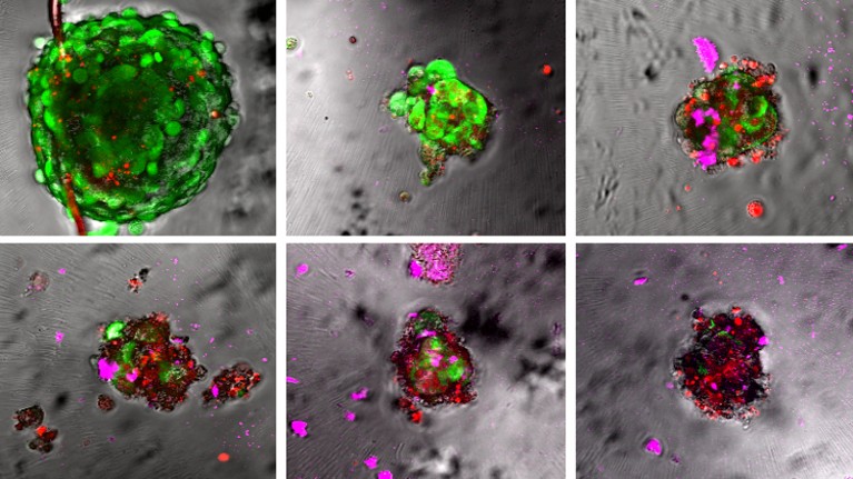 Nano-pills loaded with a potent drug infiltrate simulated tumours (living cells in green) and kill them (dead cells in red).