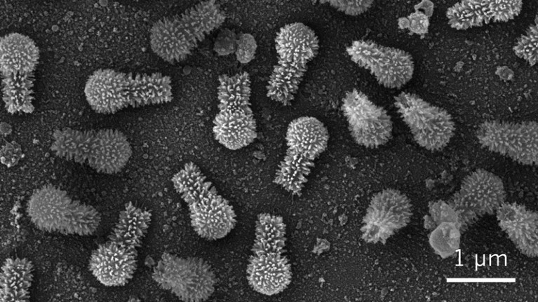 Scanning electron micrograph of Tupanvirus particles