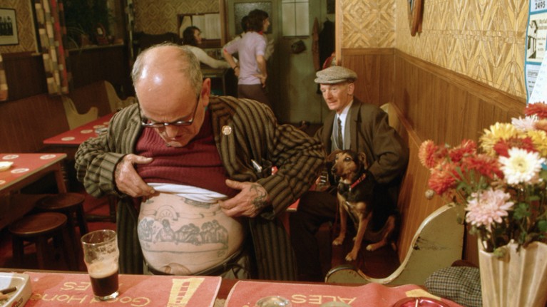 A man shows a faded tattoo on his belly