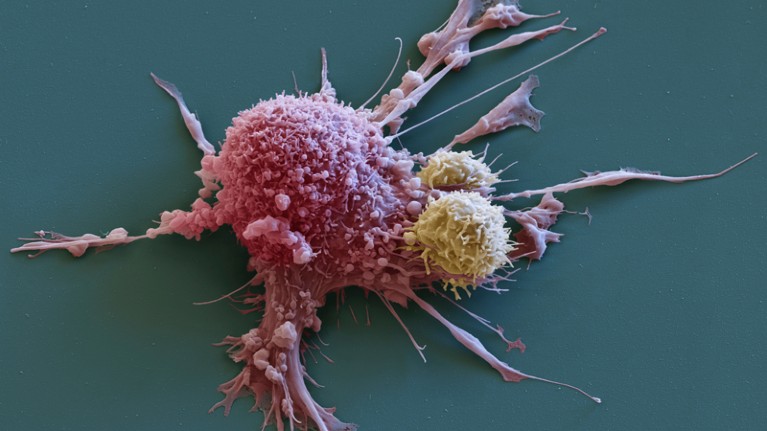 Breast cancer cell being attacked by CAR T-cell
