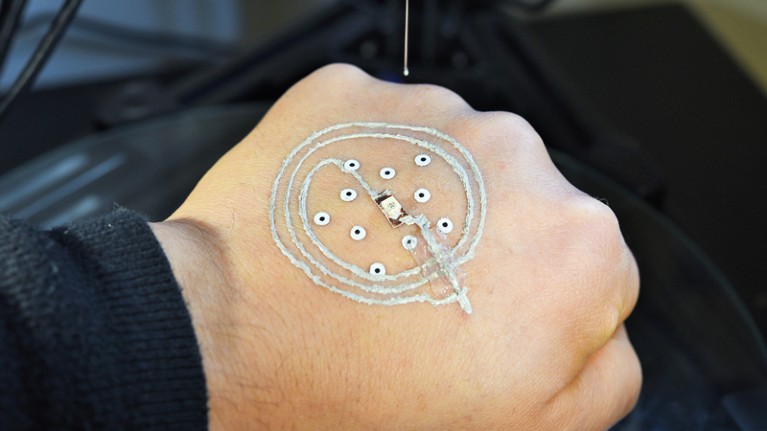 Wireless device being 3D printed onto a human hand