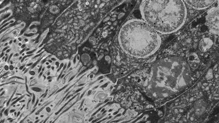 TEM image showing phagocytic intracellular digestion in amphioxus