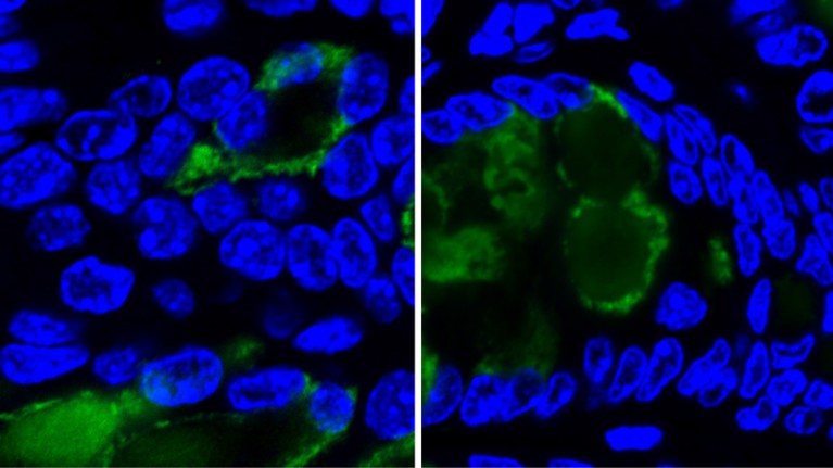 Fluorescence images of host nuclei flattened during diarrhoea