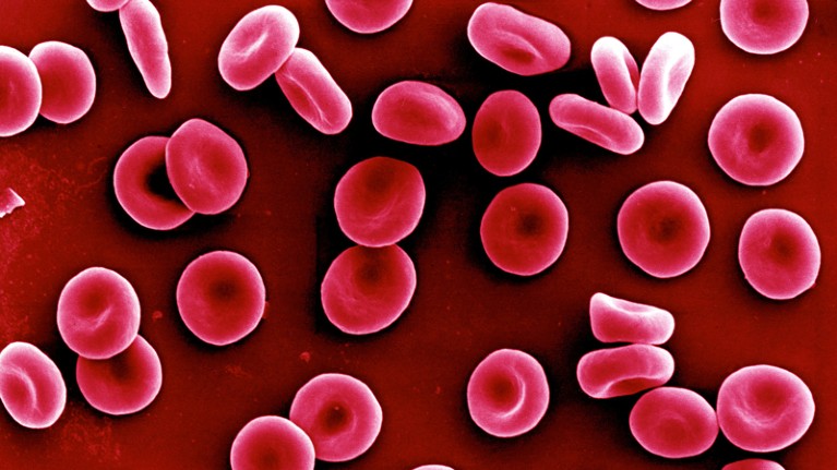 Coloured scanning electron micrograph of red blood cells