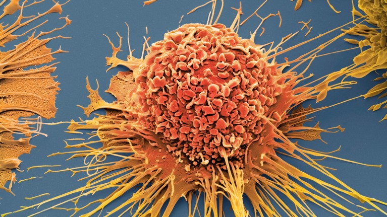 Coloured scanning electron micrograph of an activated human macrophage