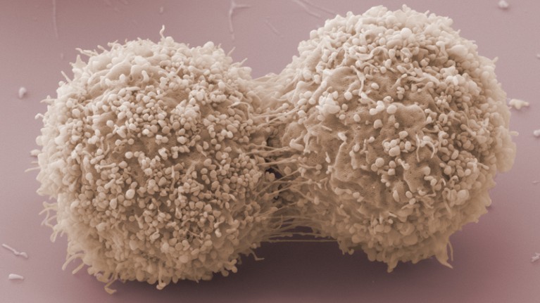 Scanning electron micrograph of dividing breast cancer cells