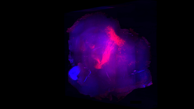 Mouse brain with doctored neurons