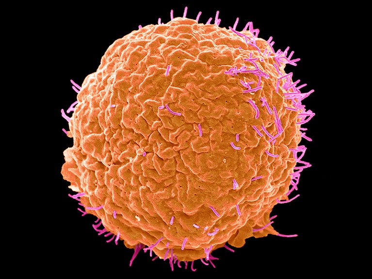 Scanning electron micrograph of human cells infected with influenza virus