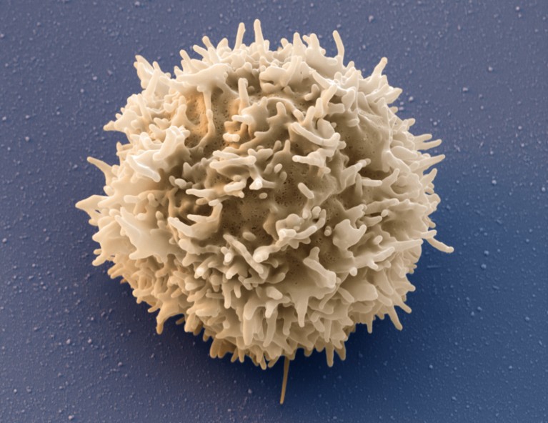 Coloured scanning electron micrograph of a chimeric antigen receptor T-cell