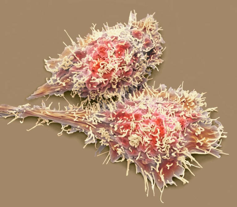 Liver cancer cells.