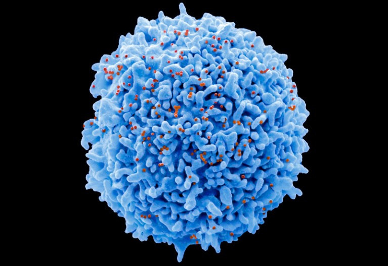 T-cell infected with HIV.