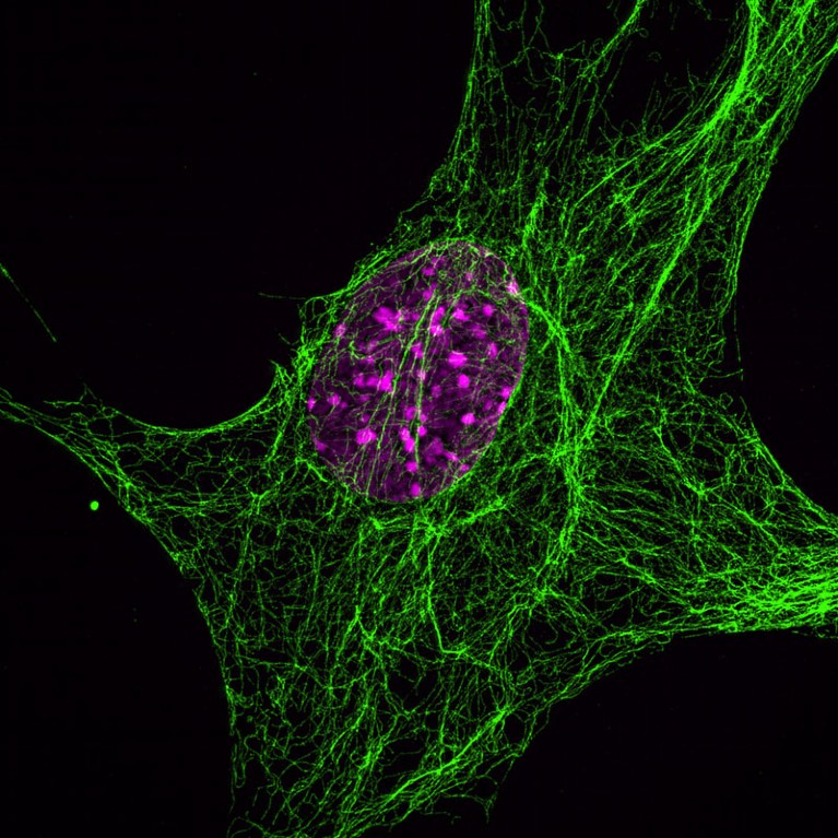 Mouse embryo fibroblast (green vimentin, red DAPI).