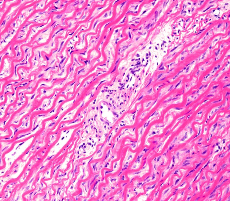 Light micrograph of the tunica media of a human aorta.