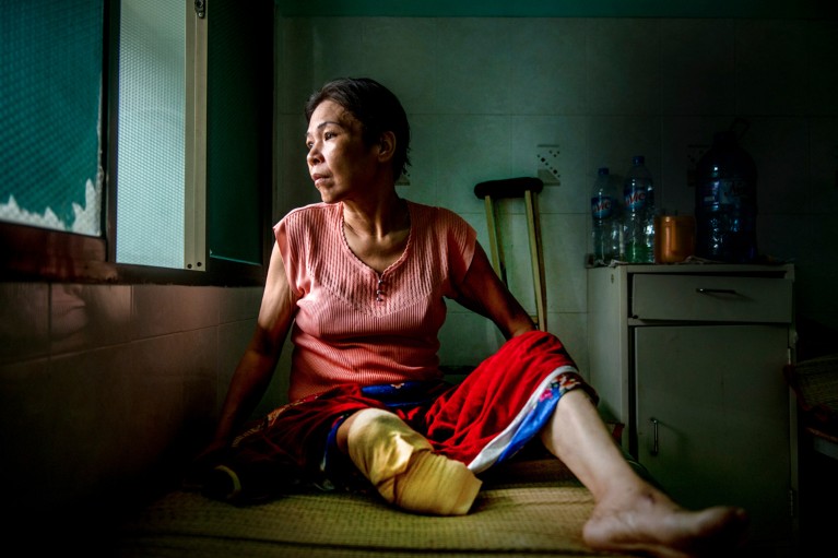 A patient with an amputated leg looks out of the window of a hospital in Vietnam