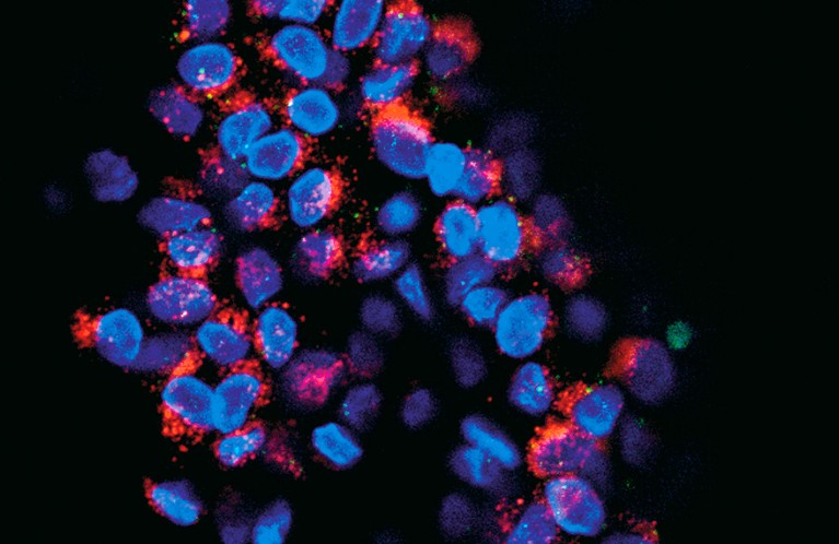 Breast-cancer cells
